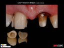 Diapositiva93.JPG